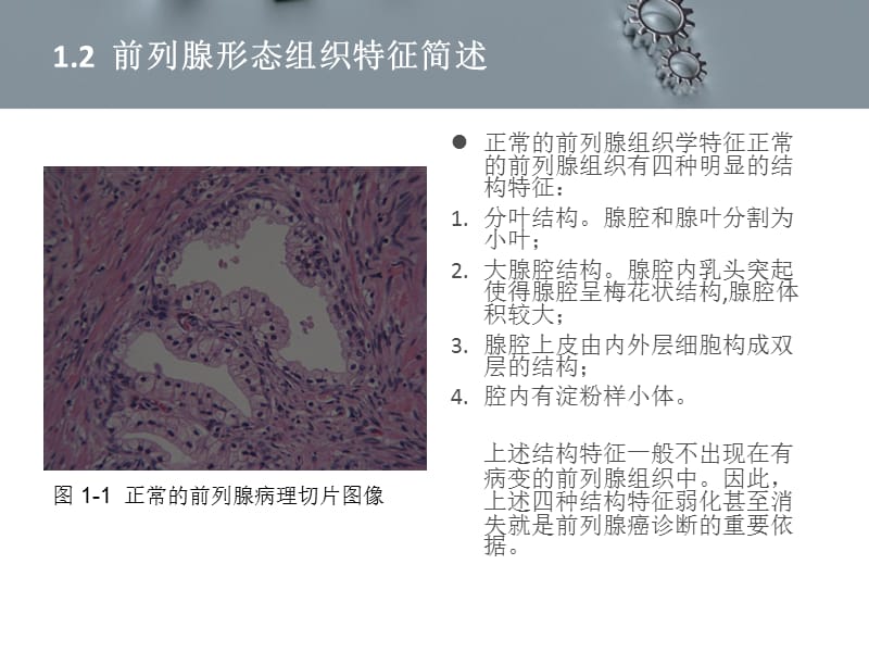 基于机器学习方法的前列腺病理切片图像识别（课堂PPT）_第5页