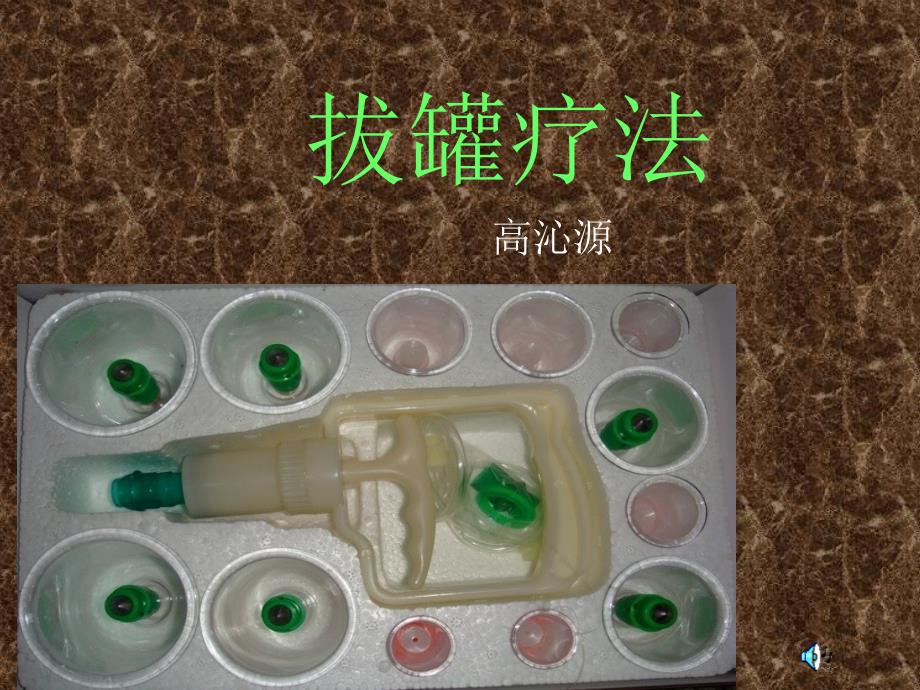 中医拔罐疗法._第1页