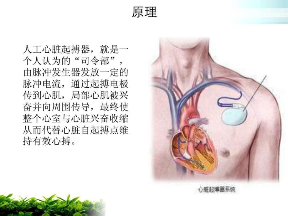 起搏器植入病人护理课件_第4页