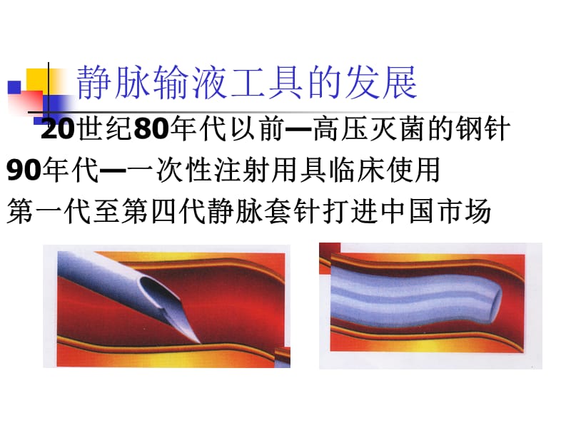 静脉输液工具合理选择_第3页