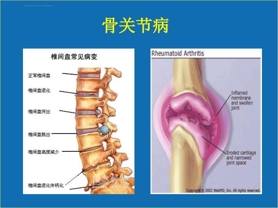 还您一个好关节 公司统一格式 店员课件_第5页