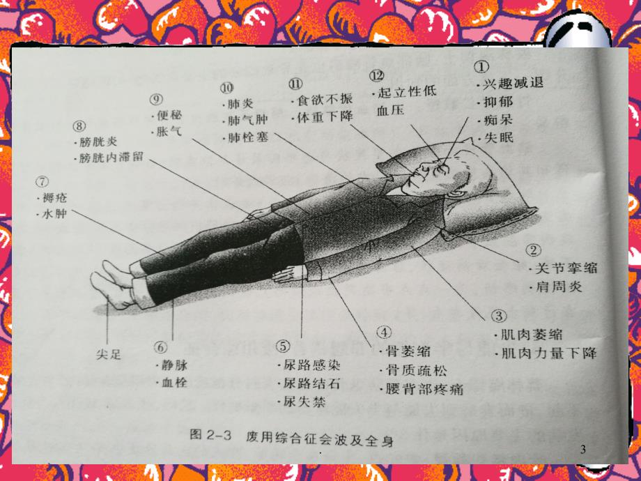 《废用综合征预防》PPT课件_第3页