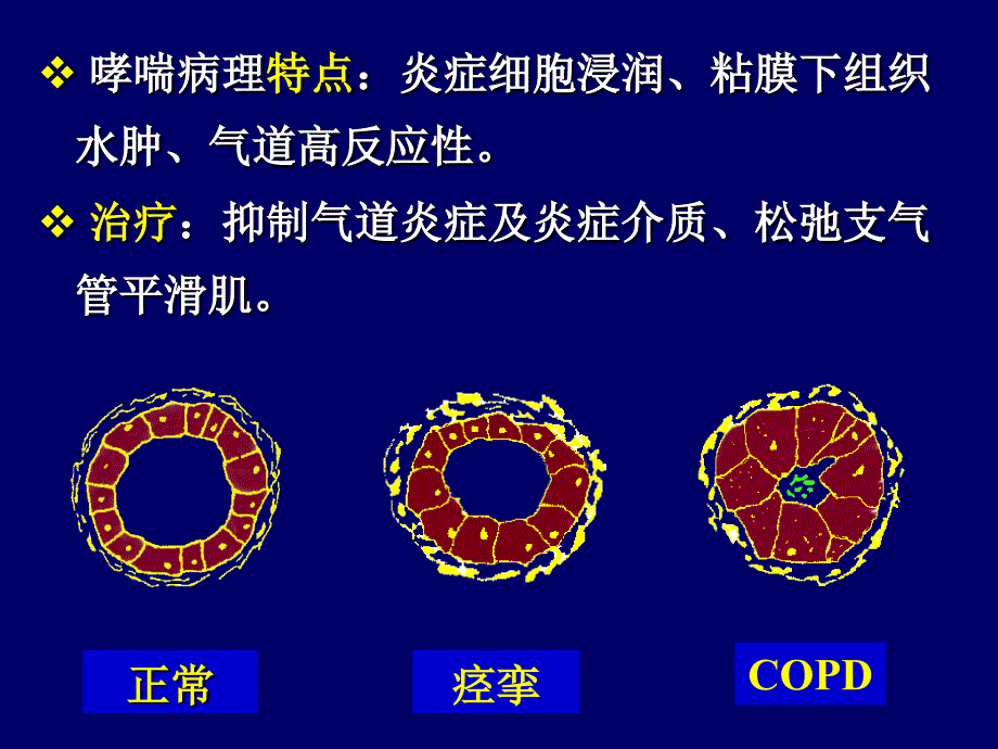 呼吸系统药物_第4页