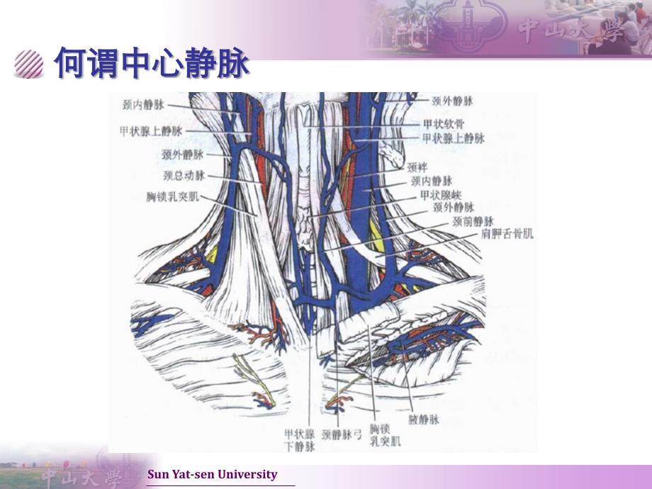 CVC置管与护理_第2页