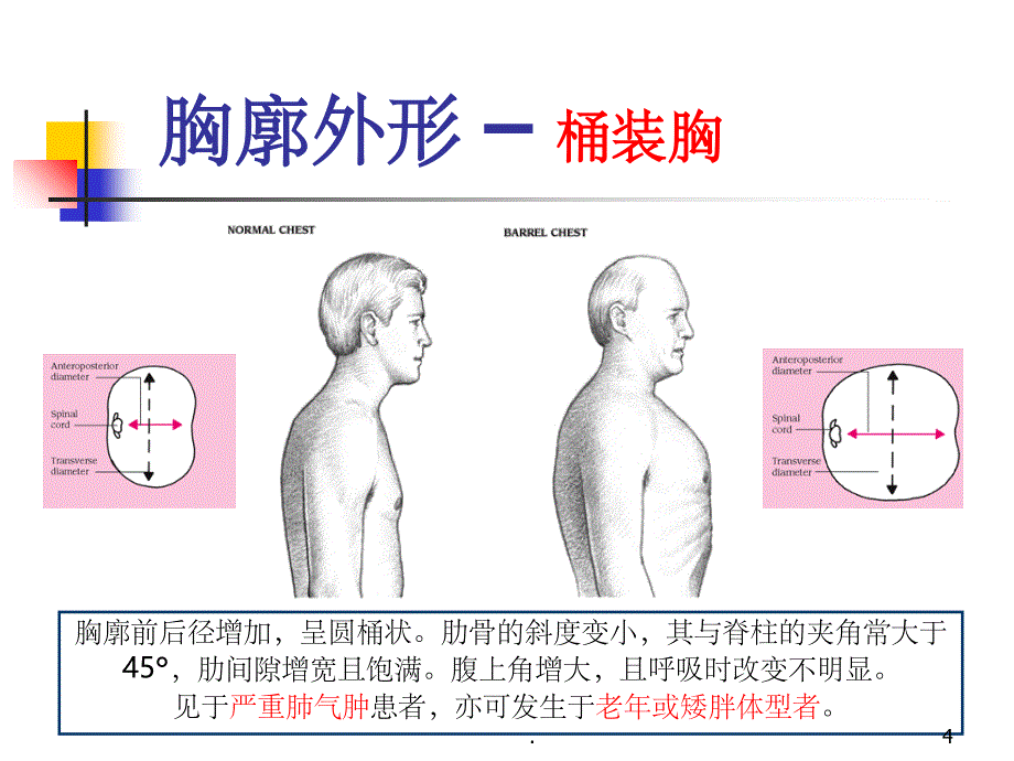 《肺部阳性体征》PPT课件_第4页