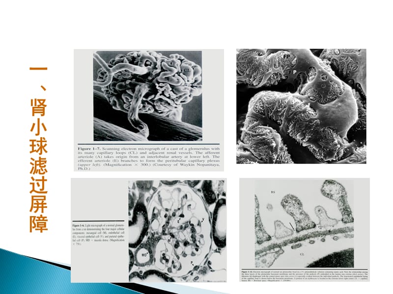 蛋白尿的诊断与鉴别精品课件_第3页
