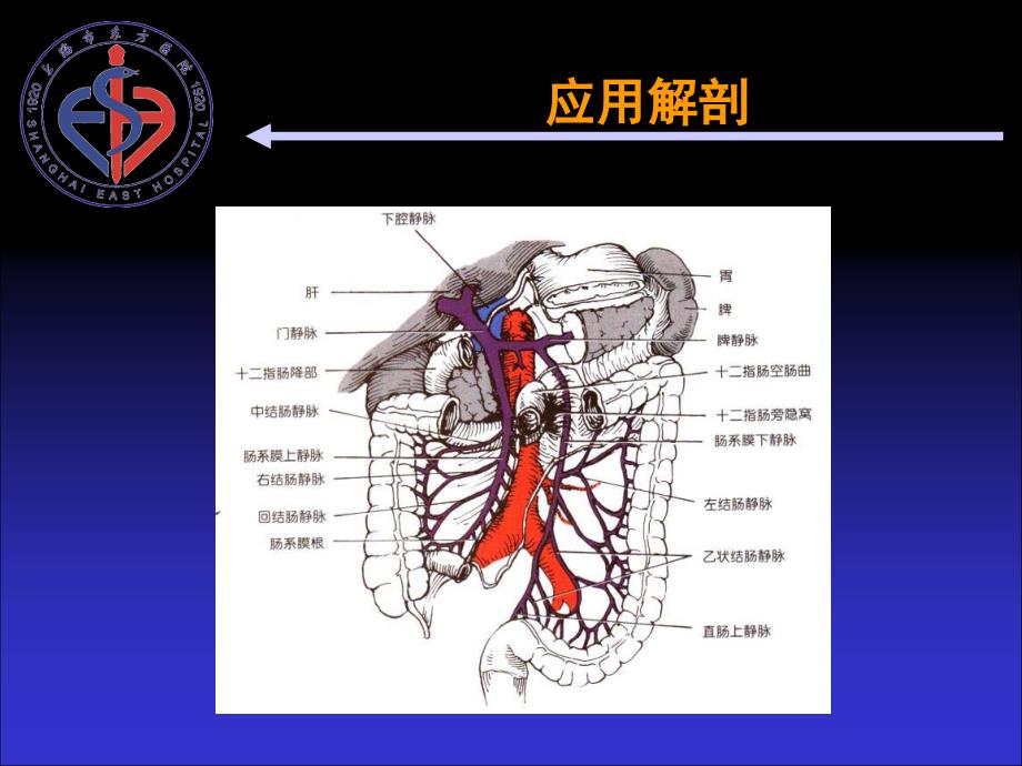 肠系膜静脉血栓-PPT课件_第2页