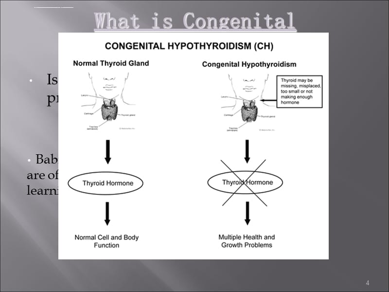 2019-先天性甲状腺功能减退-文档资料课件_第4页