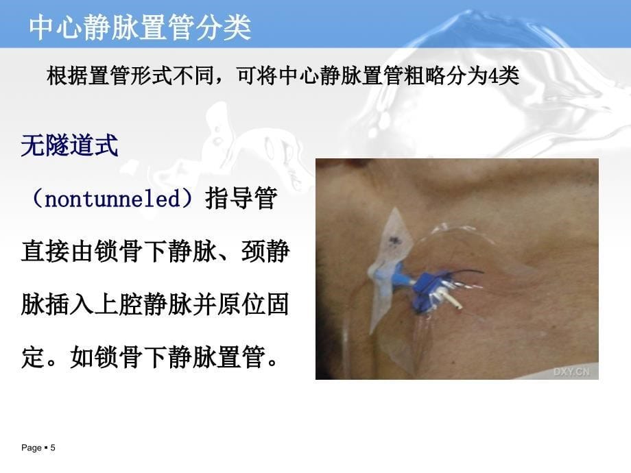 中心静脉置管术的护理(1)_第5页