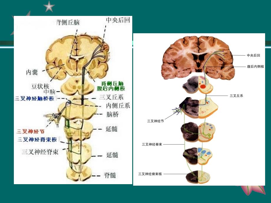 三叉神经痛PPT_第4页