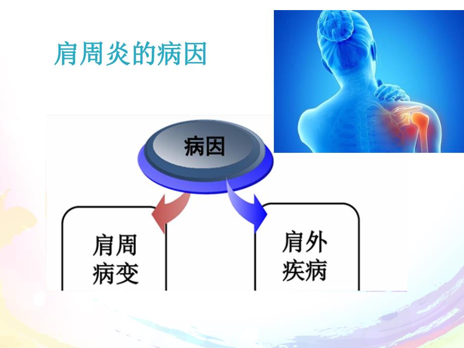 肩周炎的治疗及护理_第4页