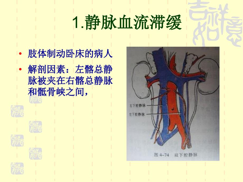 下肢深静脉血栓课件1_第4页