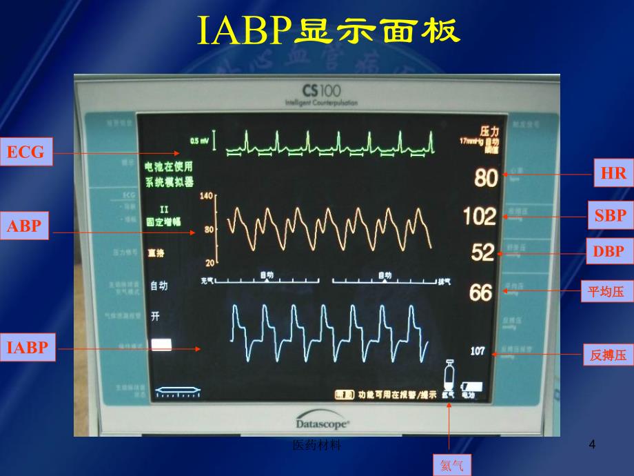 主动脉球囊反搏及监护（医学研究）_第4页