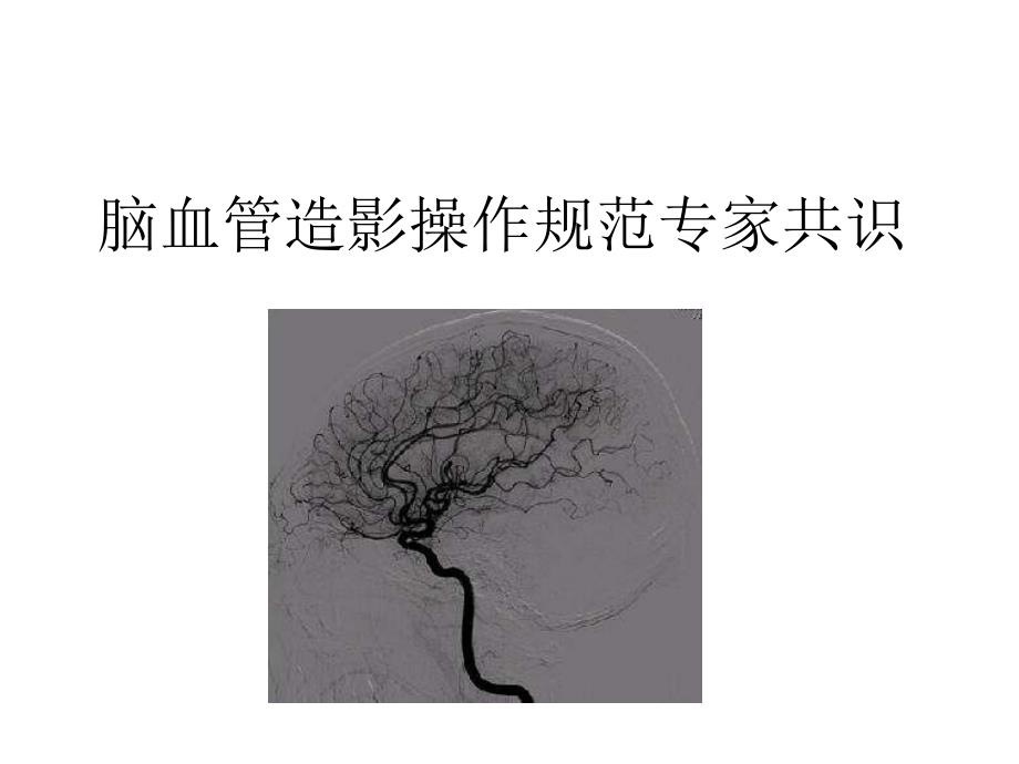 脑血管造影指南解读教学课件_第1页