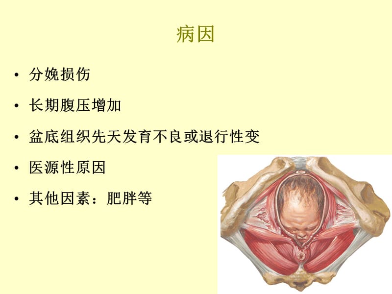 盆腔器官脱垂课件PPT12_第5页