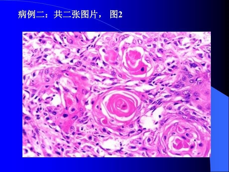 病理实验模拟考：病理解剖学实验模拟A_第5页