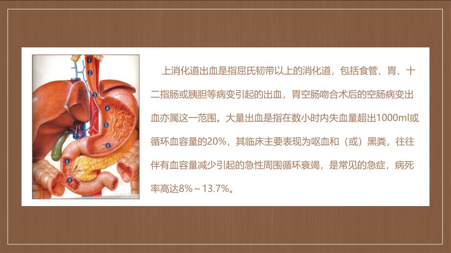 医院医疗护理上消化道出血护理查房医学PPT授课演示_第4页