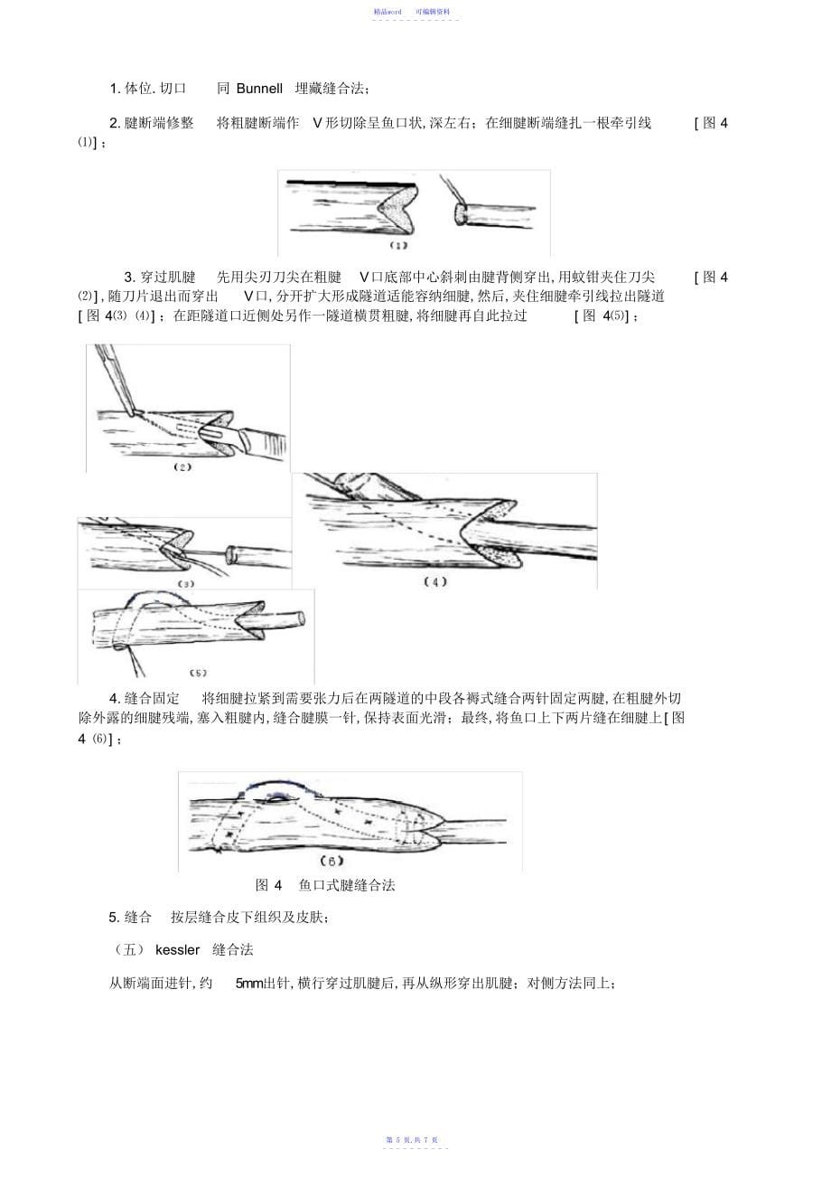 2021年肌腱缝合方法_第5页