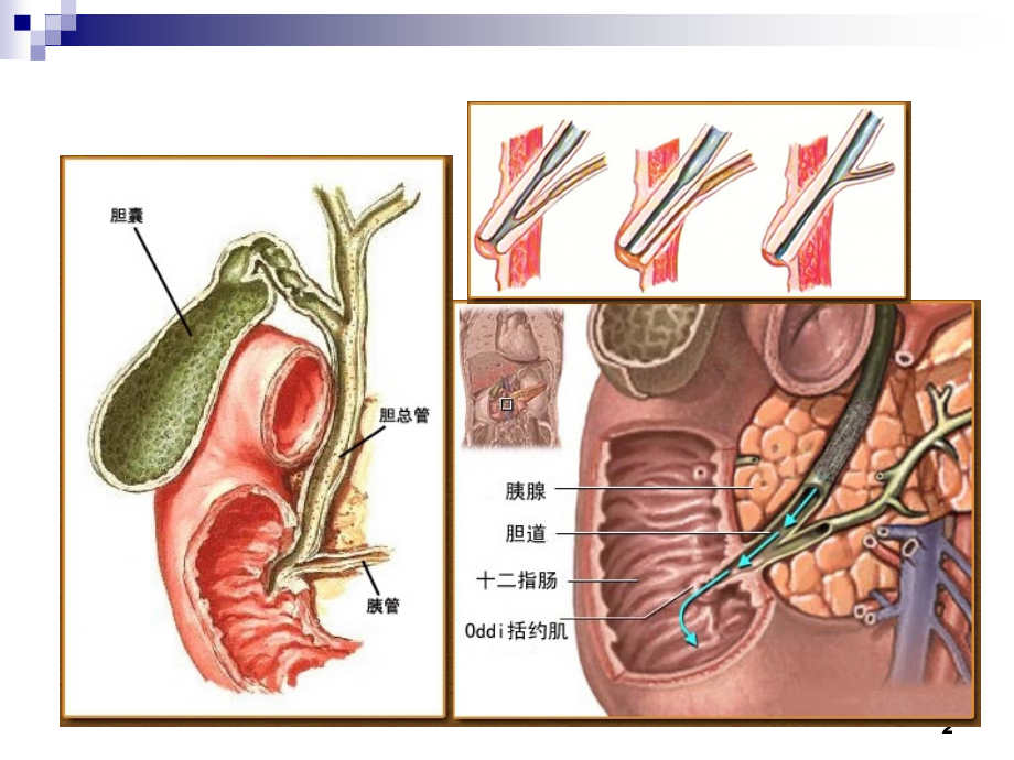 内科学课件：Acute Pancreatitis_第2页