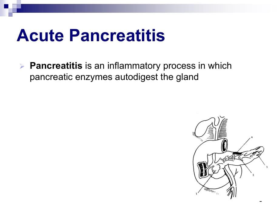 内科学课件：Acute Pancreatitis_第5页