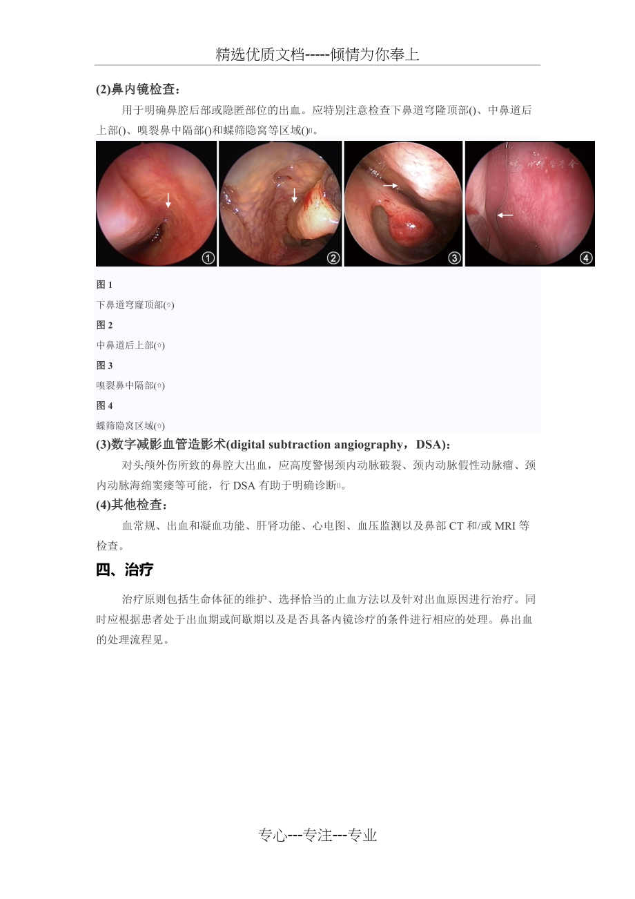 鼻出血诊断及治疗指南(草案)(共5页)_第2页