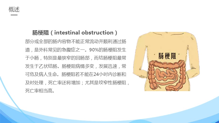 肠梗阻护理学习PPT课件_第4页