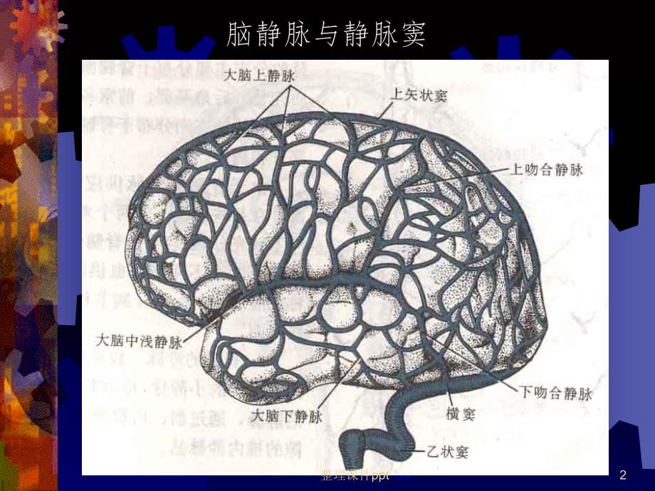 《静脉窦血栓》PPT课件_第2页