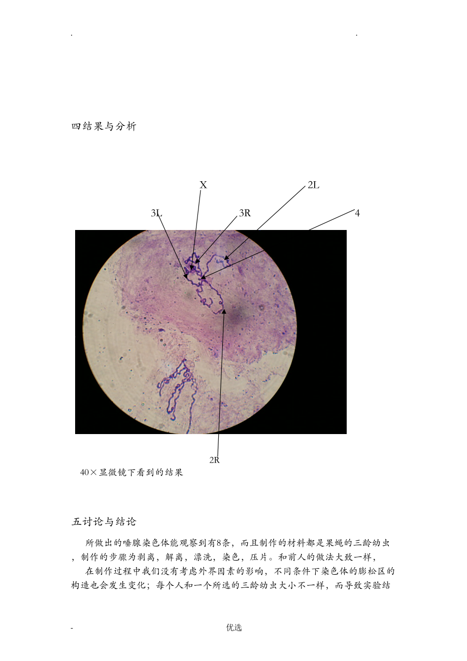 实验四果蝇唾腺染色体的观察_第4页