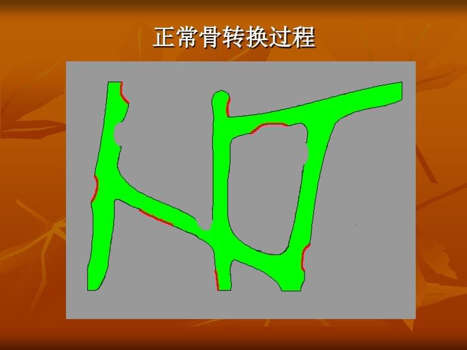 《营养学》(2011级)备课ppt课件第十七章营养与慢性疾病[4]营养与骨质疏松(Nutrition and Osteoporosis)_第5页