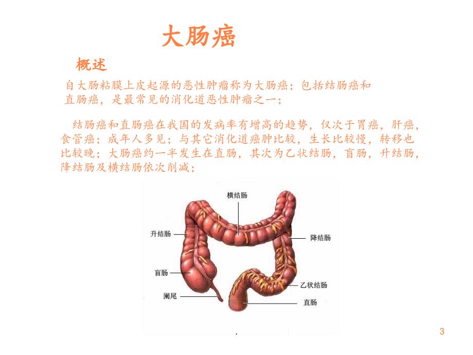 2021年大肠癌的护理PPT课件_第3页