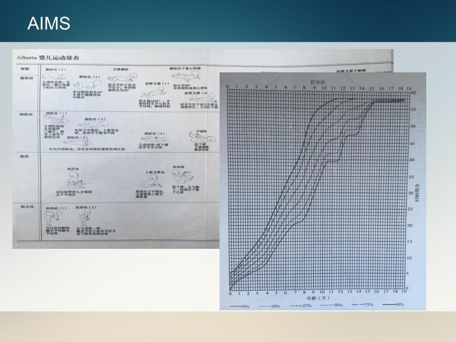 2021年儿童发育量表的应用与分析PPT课件_第5页