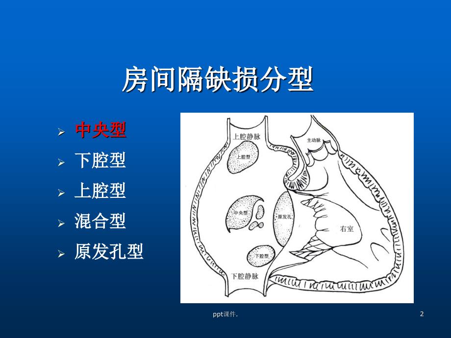 ASD介入治疗及护理ppt课件_第2页