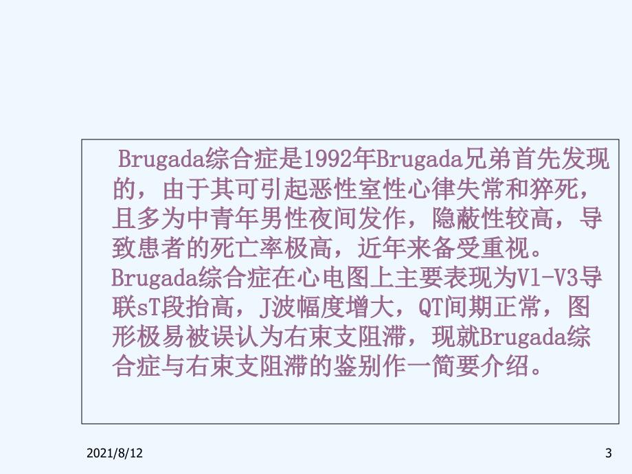 Brugada波与右束支阻滞的鉴别讲座_第3页