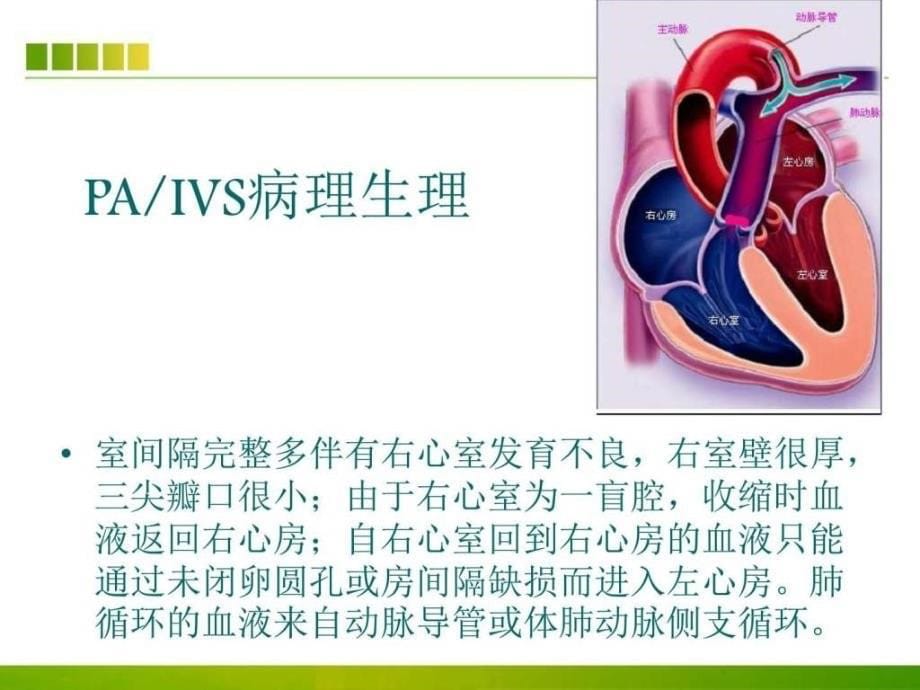 肺动脉闭锁患者的护理查房ppt课件图PPT课件03_第5页