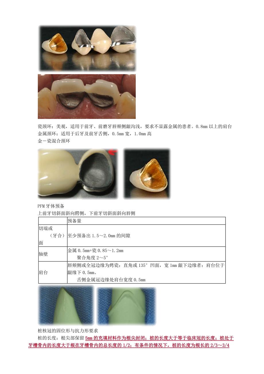 2021年口腔主治医师《专业实践能力》口腔修复学—牙体缺损修复_第3页