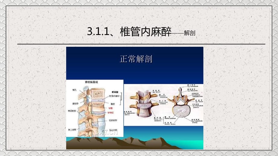 医疗教学之椎管内麻醉_第3页