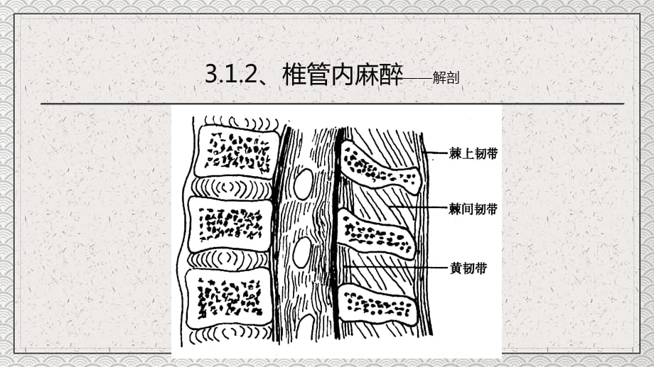 医疗教学之椎管内麻醉_第4页