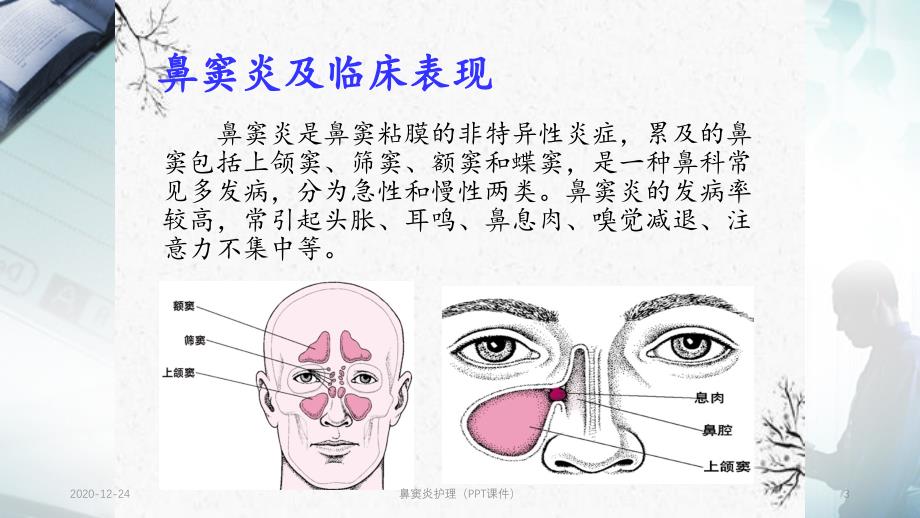 鼻窦炎护理（PPT课件）_第3页