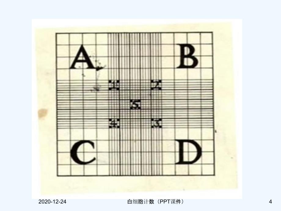 白细胞计数（PPT课件）_第4页