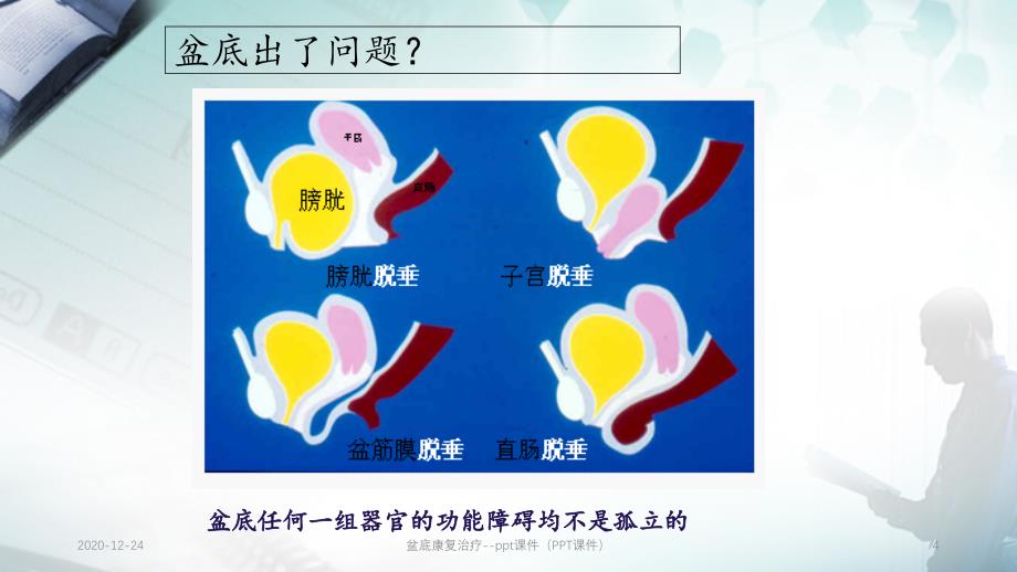 盆底康复治疗--ppt课件（PPT课件）_第4页