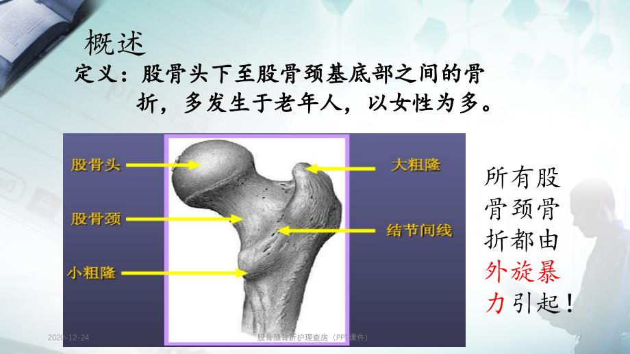 股骨颈骨折护理查房（PPT课件）_第2页