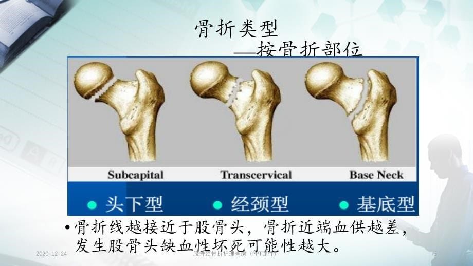 股骨颈骨折护理查房（PPT课件）_第5页