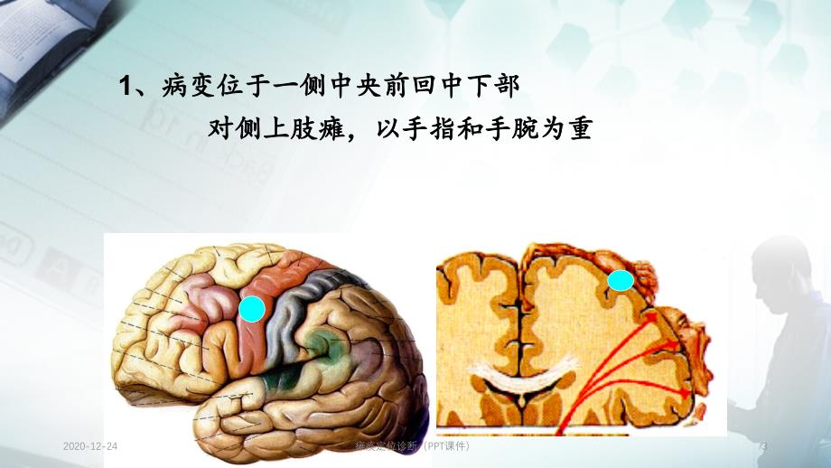 瘫痪定位诊断（PPT课件）_第3页