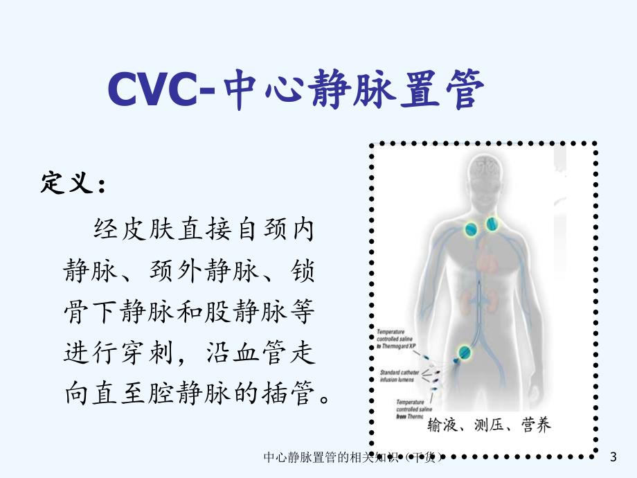 中心静脉置管的相关知识（干货）_第3页