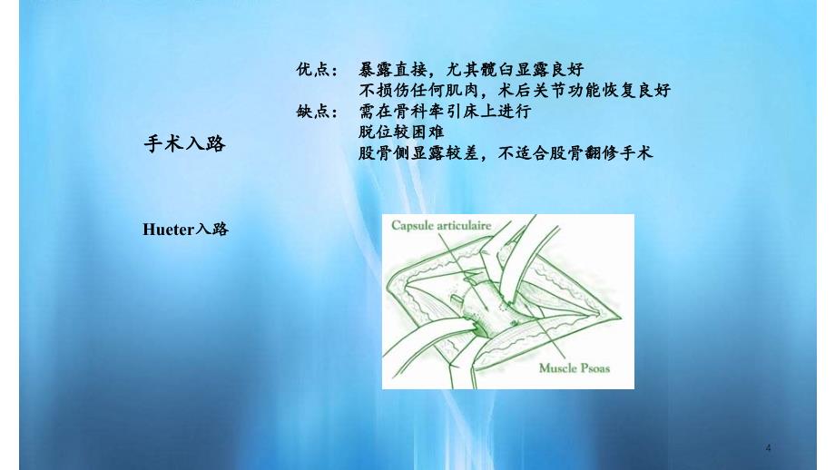 全髋关置换手术入路_第4页