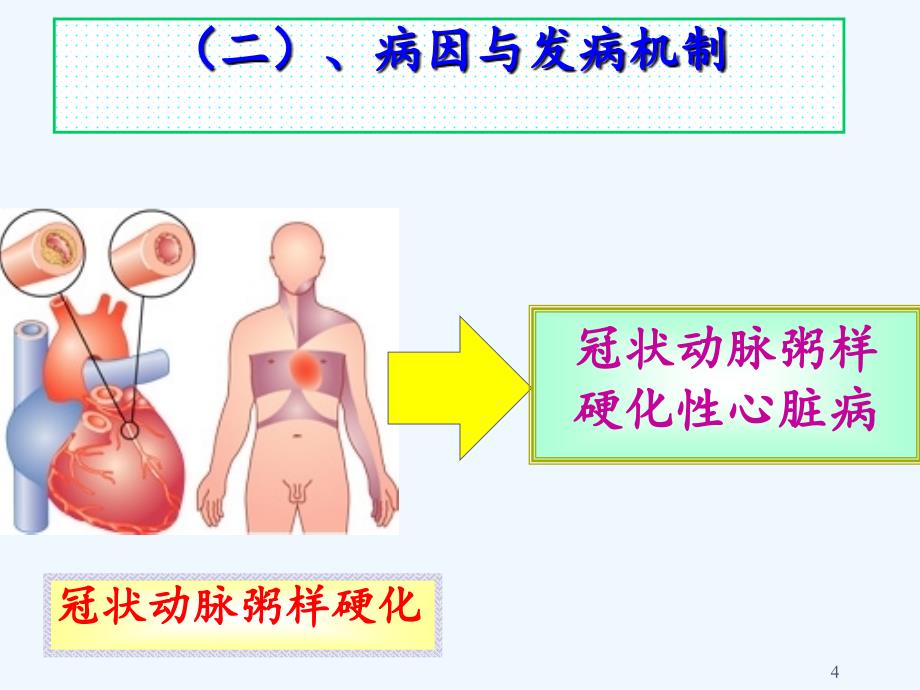 心绞痛病人的护理（实用干货）_第4页