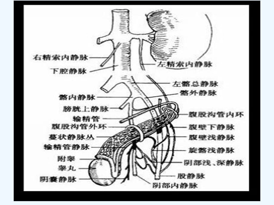 精索静脉曲张护理（实用干货）_第5页