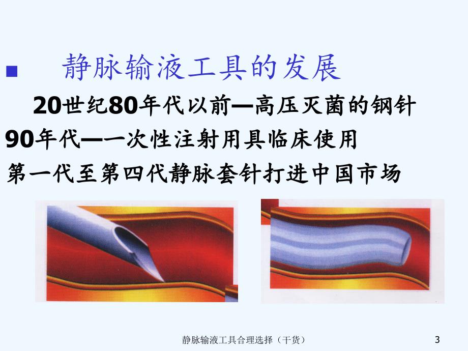 静脉输液工具合理选择（干货）_第3页