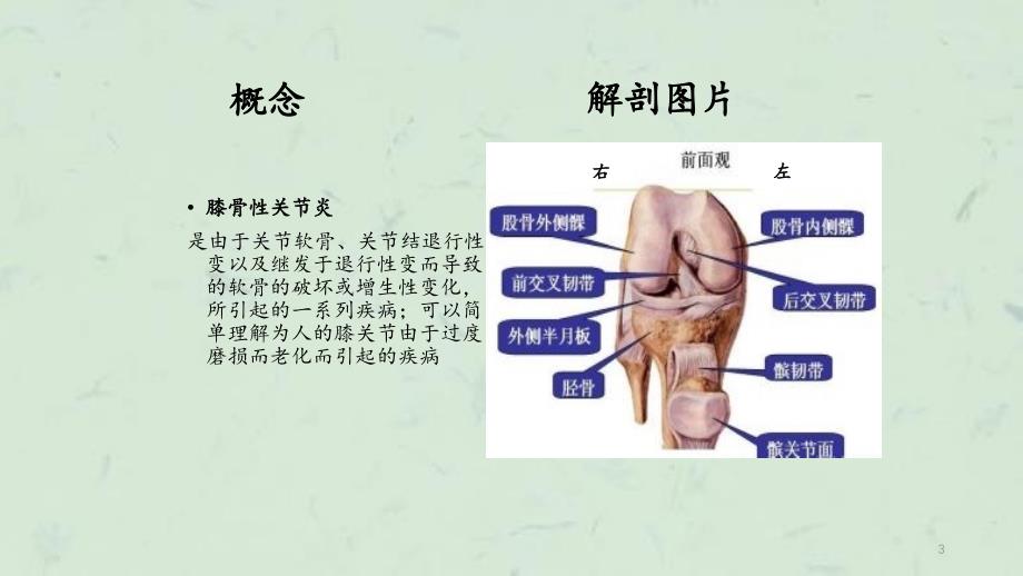 膝关骨性关炎护理查房_第3页