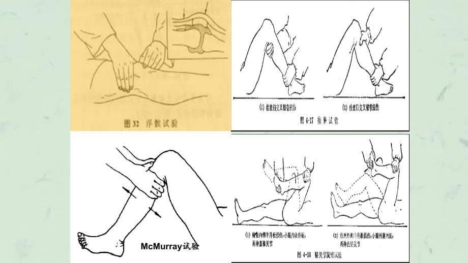 膝关骨性关炎护理查房_第5页